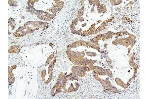 IHC analysis of OLMF4 using anti-OLMF4 antibody (ABIN6719350).