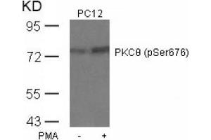Image no. 4 for anti-Protein Kinase C, theta (PRKCQ) (pSer676) antibody (ABIN197071) (PKC theta Antikörper  (pSer676))