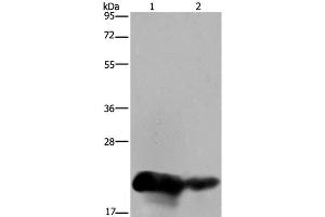 Western Blot analysis of Human placenta and breast infiltRative duct tissue using CSH1 Polyclonal Antibody at dilution of 1:200 (CSH1 Antikörper)