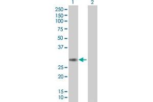Western Blot analysis of PCSK4 expression in transfected 293T cell line ( H00054760-T01 ) by PCSK4 MaxPab polyclonal antibody. (PCSK4 Antikörper  (AA 1-242))