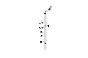 Anti-NPC1 Antibody (Center) at 1:1000 dilution + NCI- whole cell lysate Lysates/proteins at 20 μg per lane. (NPC1 Antikörper  (AA 591-620))