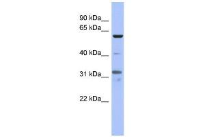 WB Suggested Anti-PAX8 Antibody Titration:  0. (PAX8 Antikörper  (Middle Region))