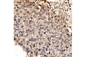IHC analysis of IFI16 using anti-IFI16 antibody (ABIN7600374). (IFI16 Antikörper  (AA 183-743))