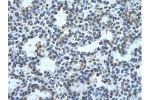 Rabbit Anti-ZMYND11 Antibody       Paraffin Embedded Tissue:  Human alveolar cell   Cellular Data:  Epithelial cells of renal tubule  Antibody Concentration:   4. (ZMYND11 Antikörper  (N-Term))