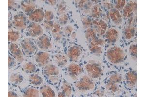 DAB staining on IHC-P; Samples: Human Stomach Tissue (Oncostatin M Antikörper  (AA 26-220))