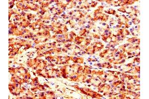 Immunohistochemistry of paraffin-embedded human pancreatic tissue using ABIN7149038 at dilution of 1:100 (CARS Antikörper  (AA 201-500))