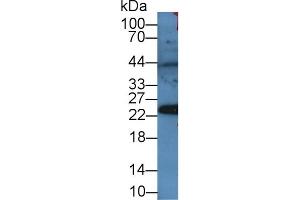 Detection of PRDX4 in Rat Serum using Polyclonal Antibody to Peroxiredoxin 4 (PRDX4) (Peroxiredoxin 4 Antikörper  (AA 14-258))