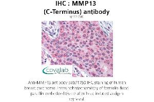 Image no. 1 for anti-Matrix Metallopeptidase 13 (Collagenase 3) (MMP13) (C-Term) antibody (ABIN1737010) (MMP13 Antikörper  (C-Term))