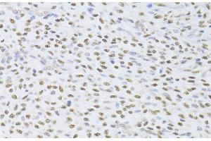 Immunohistochemistry (Paraffin-embedded Sections) (IHC (p)) image for anti-FK506 Binding Protein 4, 59kDa (FKBP4) antibody (ABIN7261592)