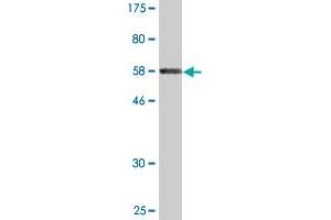 Western Blotting (WB) image for anti-Inhibitor of Growth Family, Member 2 (ING2) (AA 1-280) antibody (ABIN517180)