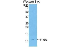 Western Blotting (WB) image for anti-CD3d Molecule, delta (CD3-TCR Complex) (CD3D) (AA 22-106) antibody (ABIN3205925) (CD3D Antikörper  (AA 22-106))