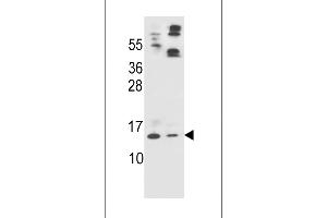 Western blot analysis in HL-60(lane 1),A549(lane 2) cell line lysates (35ug/lane). (Apolipoprotein C-II Antikörper  (AA 45-73))