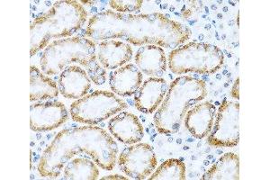 Immunohistochemistry of paraffin-embedded Mouse kidney using INHBC Polyclonal Antibody at dilution of 1:100 (40x lens).