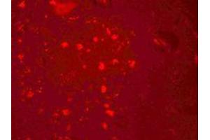 Immunofluorescence (IF) image for anti-Zinc Finger, CCCH-Type with G Patch Domain (ZGPAT) (C-Term) antibody (ABIN1030822) (ZGPAT Antikörper  (C-Term))