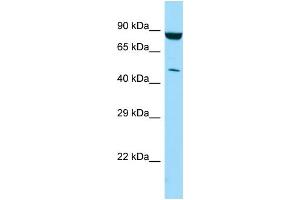 WB Suggested Anti-PIP4K2C Antibody Titration: 1. (PIP4K2C Antikörper  (C-Term))