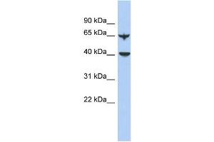 Human Lung; WB Suggested Anti-APOBEC4 Antibody Titration: 0. (APOBEC4 Antikörper  (N-Term))