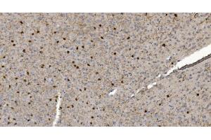 IHC analysis of Alpha B Crystallin/CRYAB using anti-Alpha B Crystallin/CRYAB antibody (ABIN7601209). (CRYAB Antikörper  (AA 30-151))