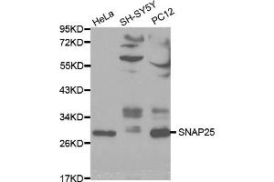 Western blot analysis of extracts of various cell lines, using SNAP25 antibody (ABIN5970374) at 1/1000 dilution. (SNAP25 Antikörper)