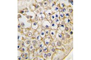 Image no. 2 for anti-Transient Receptor Potential Cation Channel, Subfamily V, Member 3 (TRPV3) (C-Term) antibody (ABIN356906)