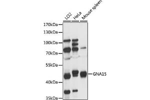 Western blot analysis of extracts of various cell lines, using GN antibody (ABIN7267536) at 1:1000 dilution.
