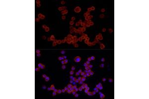 Immunofluorescence analysis of R. (NLRP3 Antikörper  (C-Term))