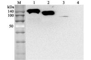 Western blot analysis using anti-ACE2 (human), mAb (AC384)  at 1:2'000 dilution. (ACE2 Antikörper)