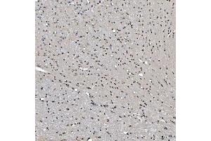 IHC analysis of SNRNP27 using anti-SNRNP27 antibody (ABIN7599614). (SNRNP27 Antikörper  (AA 100-155))