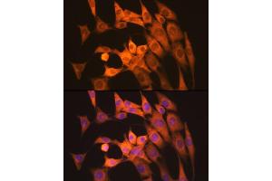 Immunofluorescence analysis of NIH-3T3 cells using Calpain 1 Rabbit mAb (ABIN7266033) at dilution of 1:100 (40x lens). (CAPNL1 Antikörper)