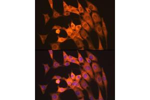 Immunofluorescence analysis of NIH-3T3 cells using Calpain 1 Rabbit mAb (ABIN7266033) at dilution of 1:100 (40x lens). (CAPNL1 Antikörper)