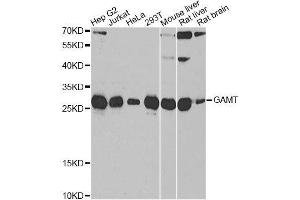 Western blot analysis of extracts of various cell lines, using GAMT antibody. (GAMT Antikörper  (AA 1-236))