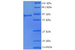 SDS-PAGE (SDS) image for BEN Domain Containing 3 (BEND3) (AA 328-461), (partial) protein (GST tag) (ABIN5711413) (BEND3 Protein (AA 328-461, partial) (GST tag))