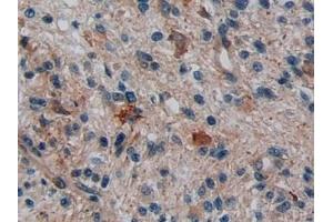 Immunohistochemistry (IHC) image for anti-Disrupted in Schizophrenia 1 (DISC1) (AA 102-261) antibody (ABIN7439720)
