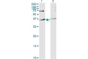Western Blot analysis of RNF144B expression in transfected 293T cell line by IBRDC2 monoclonal antibody (M02), clone 4F1. (RNF144B Antikörper  (AA 1-100))