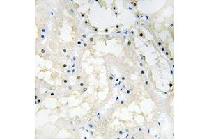 Immunohistochemical analysis of NR2F2 staining in human kidney formalin fixed paraffin embedded tissue section. (NR2F2 Antikörper  (N-Term))