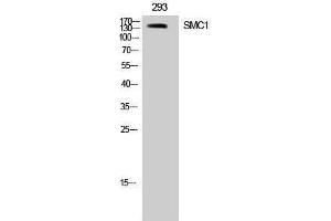 Western Blotting (WB) image for anti-Structural Maintenance of Chromosomes 1A (SMC1A) (Tyr353) antibody (ABIN3177443) (SMC1A Antikörper  (Tyr353))