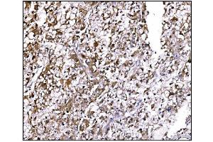 IHC analysis of LILRB1 using anti-LILRB1 antibody (ABIN7601409).