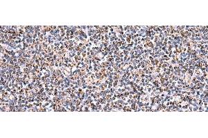 Immunohistochemistry of paraffin-embedded Human tonsil tissue using HSF2BP Polyclonal Antibody at dilution of 1:30(x200) (HSF2BP Antikörper)