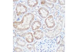 Immunohistochemistry (IHC) image for anti-NADH Dehydrogenase (Ubiquinone) 1 beta Subcomplex, 4, 15kDa (NDUFB4) (AA 1-90) antibody (ABIN6144476)