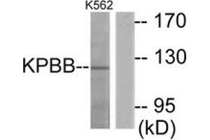 Western blot analysis of extracts from K562 cells, using KPBB Antibody. (PHKB Antikörper  (AA 661-710))