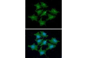 ICC/IF analysis of FKBP14 in HeLa cells line, stained with DAPI (Blue) for nucleus staining and monoclonal anti-human FKBP14 antibody (1:100) with goat anti-mouse IgG-Alexa fluor 488 conjugate (Green). (FKBP14 Antikörper)