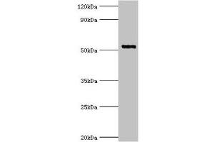 Western blot All lanes: Interleukin-1 receptor-associated kinase 4 antibody at 4 μg/mL + Jurkat whole cell lysate Secondary Goat polyclonal to rabbit IgG at 1/10000 dilution Predicted band size: 52, 38 kDa Observed band size: 52 kDa (IRAK4 Antikörper  (AA 1-220))