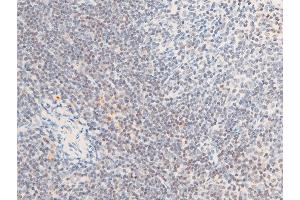 ABIN6267285 at 1/100 staining mouse spleen tissue sections by IHC-P. (ErbB2/Her2 Antikörper  (pTyr1112))
