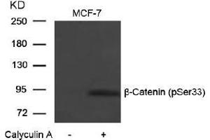 Image no. 1 for anti-Catenin (Cadherin-Associated Protein), beta 1, 88kDa (CTNNB1) (pSer33) antibody (ABIN196956) (CTNNB1 Antikörper  (pSer33))