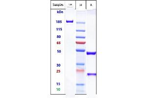 Anti-IgE Reference Antibody (talizumab) on SDS-PAGE under reducing (R) condition. (Rekombinanter IgE (Talizumab Biosimilar) Antikörper)