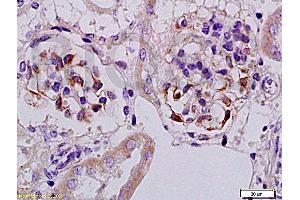Formalin-fixed and paraffin embedded rat kidney tissue with Anti-Megsin Polyclonal Antibody, Unconjugated (ABIN728548) at 1:200, followed by conjugation to the secondary antibody and DAB staining (SERPINB7 Antikörper  (AA 301-380))