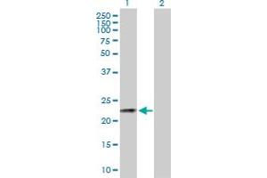 Western Blot analysis of CSN3 expression in transfected 293T cell line by CSN3 MaxPab polyclonal antibody.