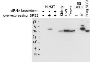 Image no. 1 for anti-Selenophosphate Synthetase 2 (SEPHS2) antibody (ABIN401044)