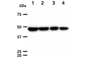The cell lysates (40ug) were resolved by SDS-PAGE, transferred to PVDF membrane and probed with anti-human TUBG1 antibody (1:1000).