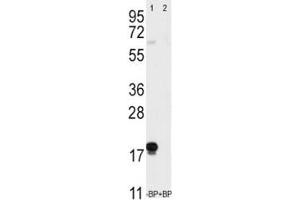 Western Blotting (WB) image for anti-CD90 (THY1) (AA 36-65) antibody (ABIN3028558)