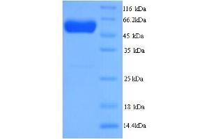 SDS-PAGE (SDS) image for D-2-Hydroxyglutarate Dehydrogenase (D2HGDH) (AA 56-533) protein (His tag) (ABIN5714248)